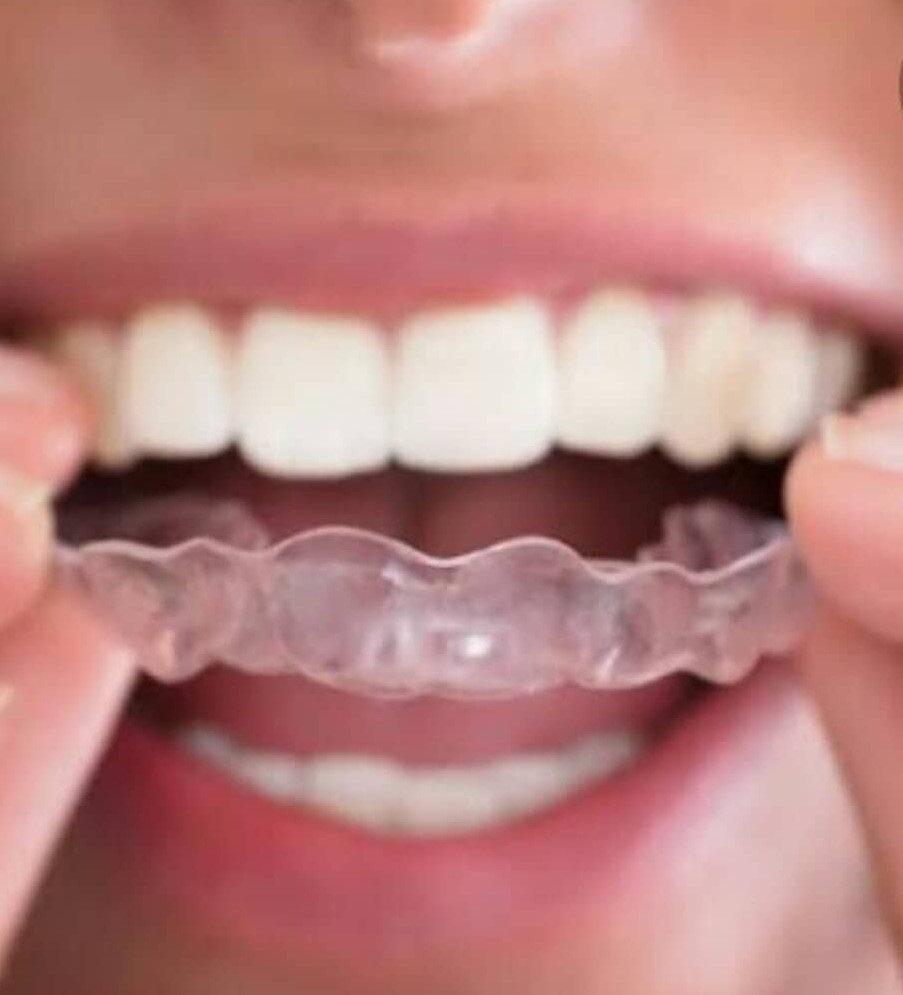 Dental Care Excellence