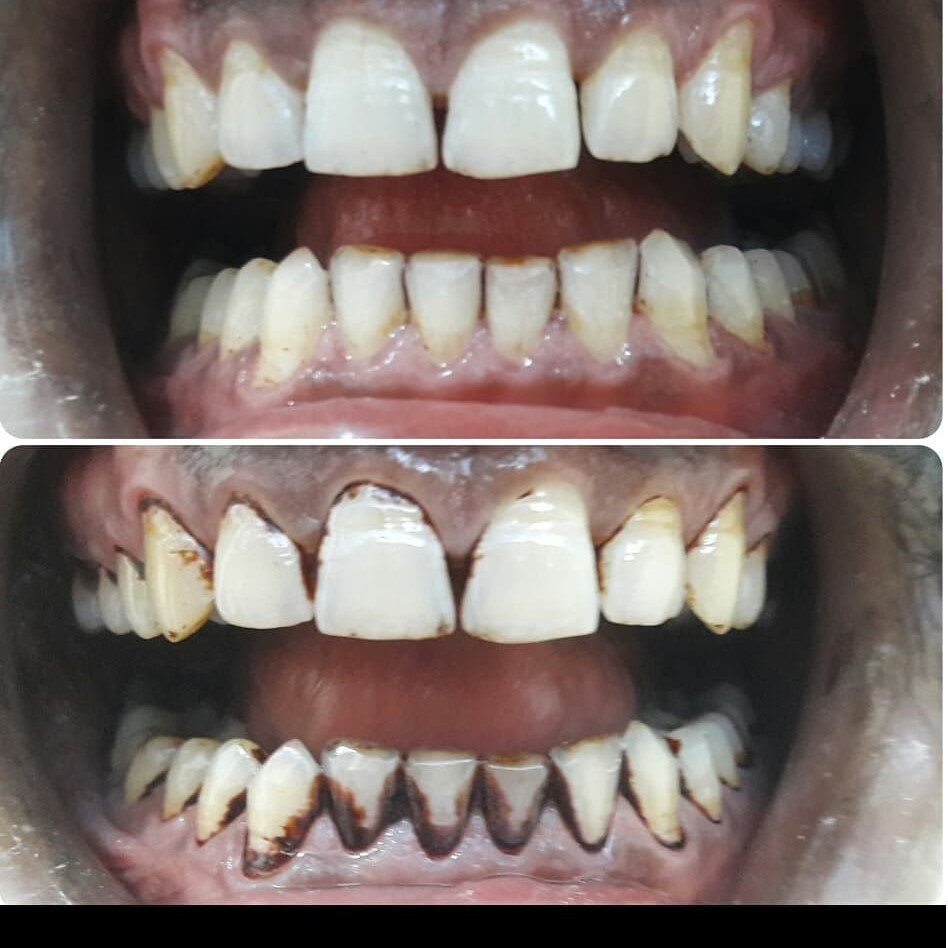 Smile Makeover Specialists
